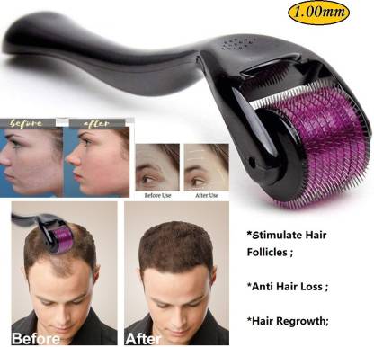 Derma Roller for Hair Regrowth & Skin – Microneedle Therapy for Men & Women